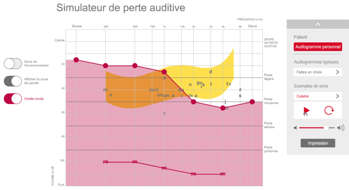Simulateur de perte auditive de Connexx - Signia