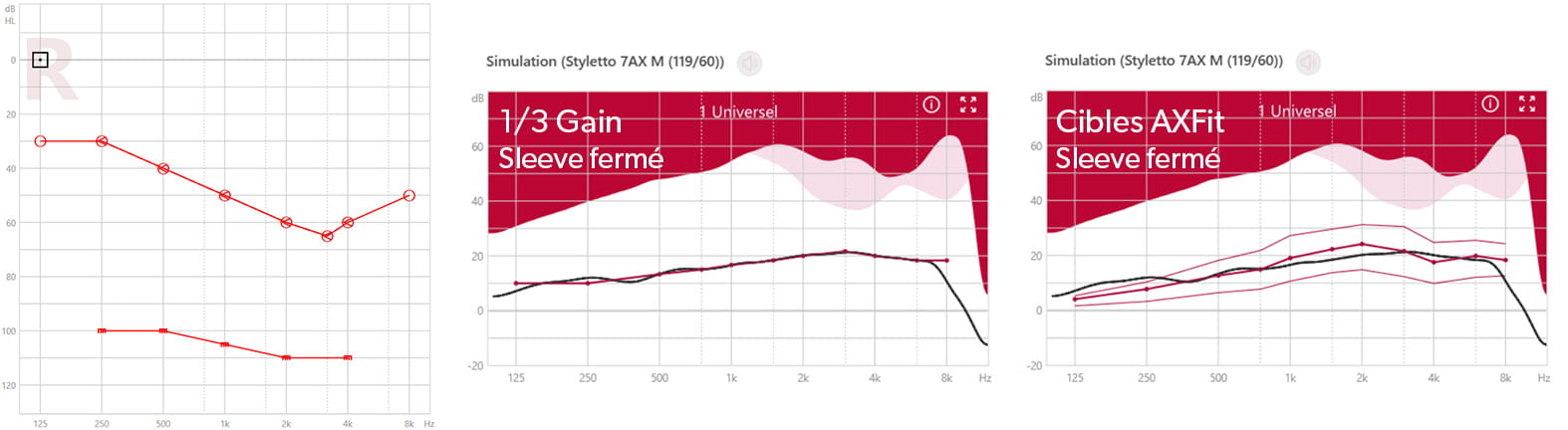 zoom Signia - Fig. 1 : Comparatif 1/3 Gain et AXFit sur une adaptation fermée