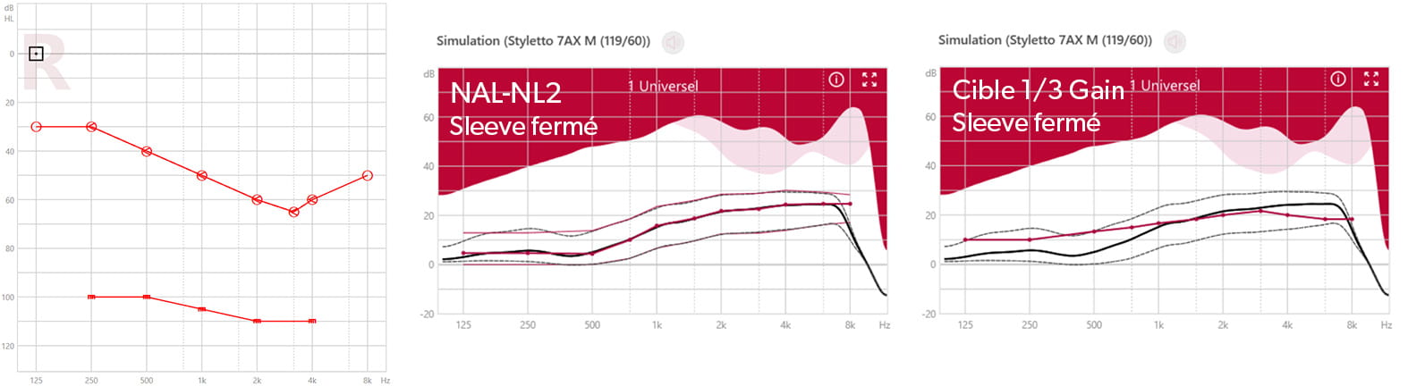 zoom signia - Fig. 4 : Comparatif NAL-NL2 et 1/3 Gain sur une adaptation fermée