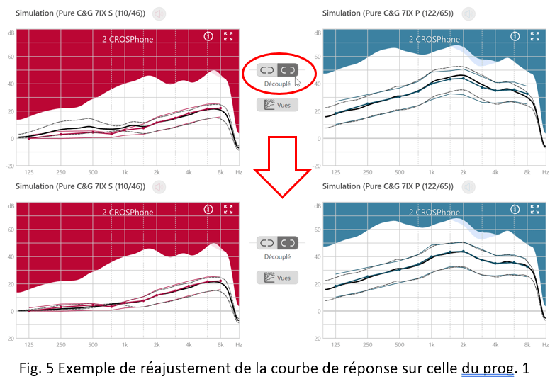ZOOM Signia TriCROS sur l'appareillage de la perte auditive avec vocale fortement asymétrique figure 5