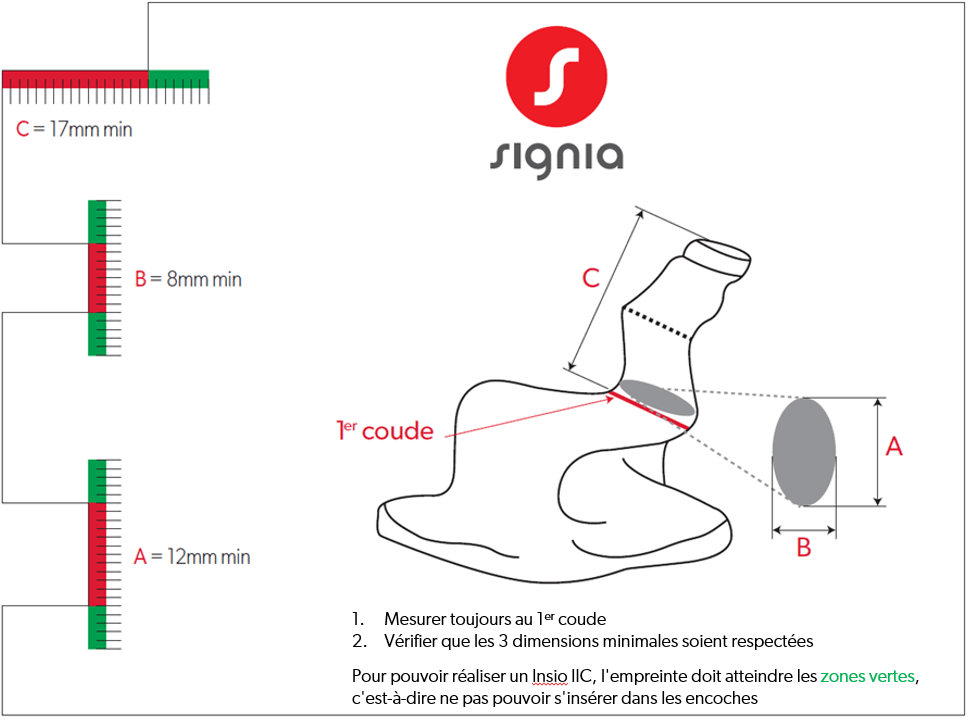 schéma des caractéristiques du conduit auditif permettant la réalisation de l'intra-auriculaire sur-mesure insio IX