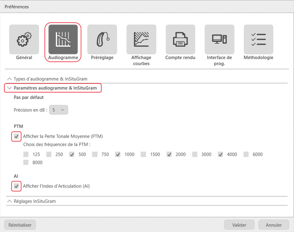 Menu audiogramme dans connexx de signia