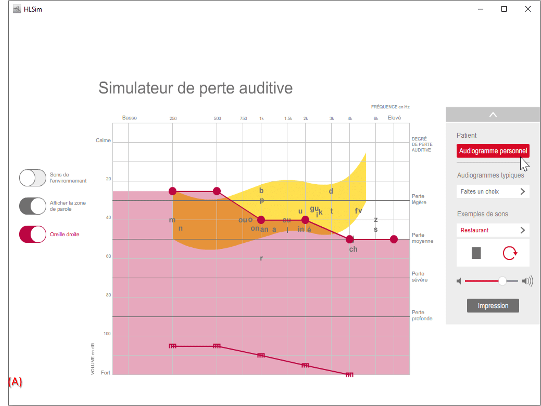 Exemple d'audiogramme de malentendant depuis le simulateur de perte de Connexx