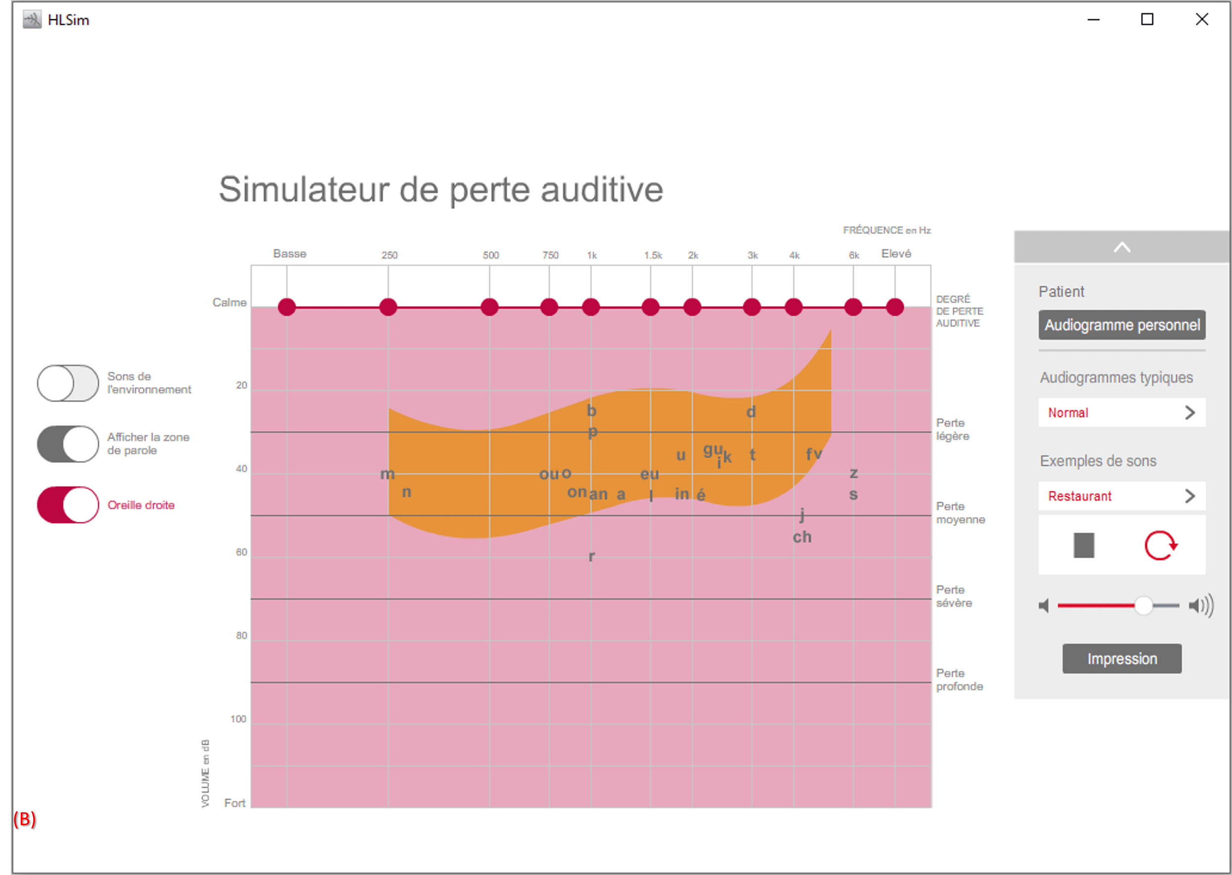 Exemple d'audiogramme de normoentendant depuis le simulateur de perte de Connexx