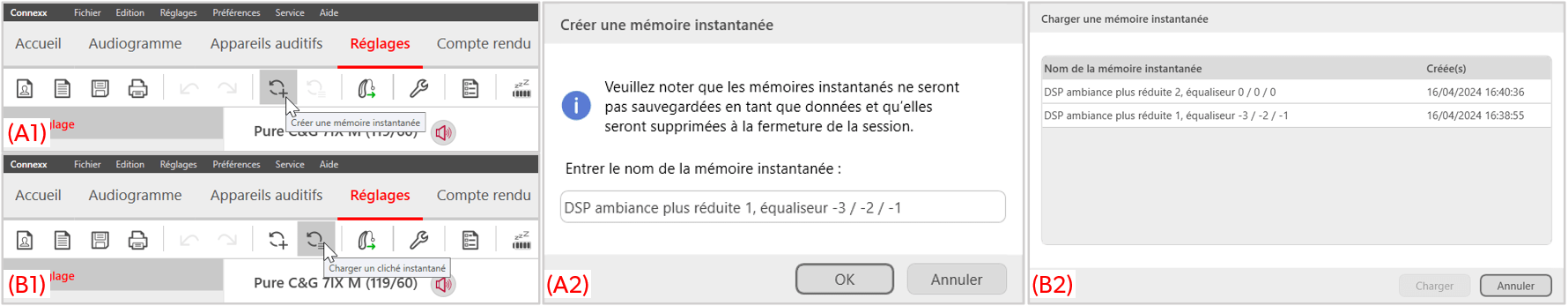 L'utilisation des mémoires instantannées dans Connexx de Signia