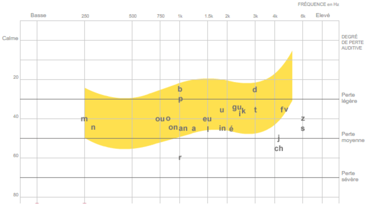 figure 5 Simulateur de perte auditive affichant les phonèmes sur laudiogramme