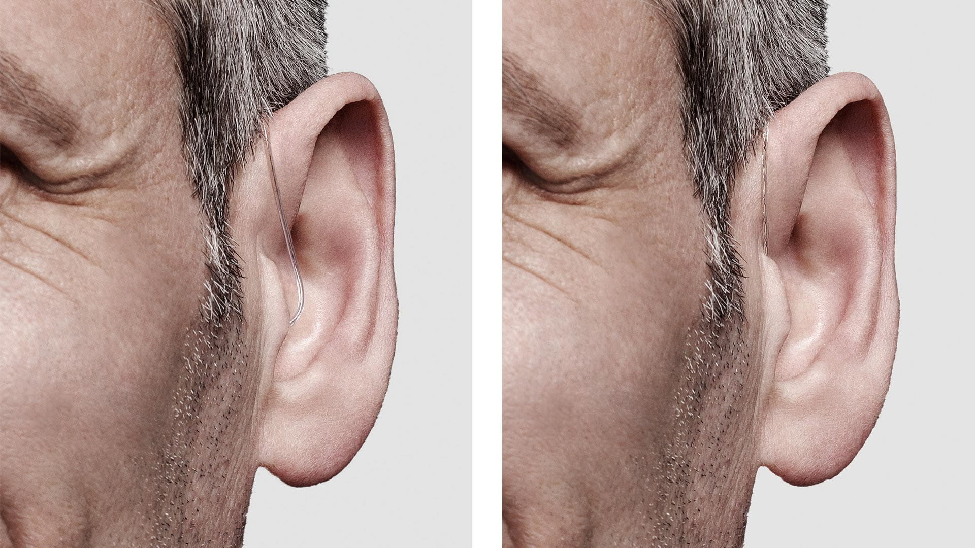 Tulipas Eartip 3.0 para audífonos Signia, Rexton y Audio Service