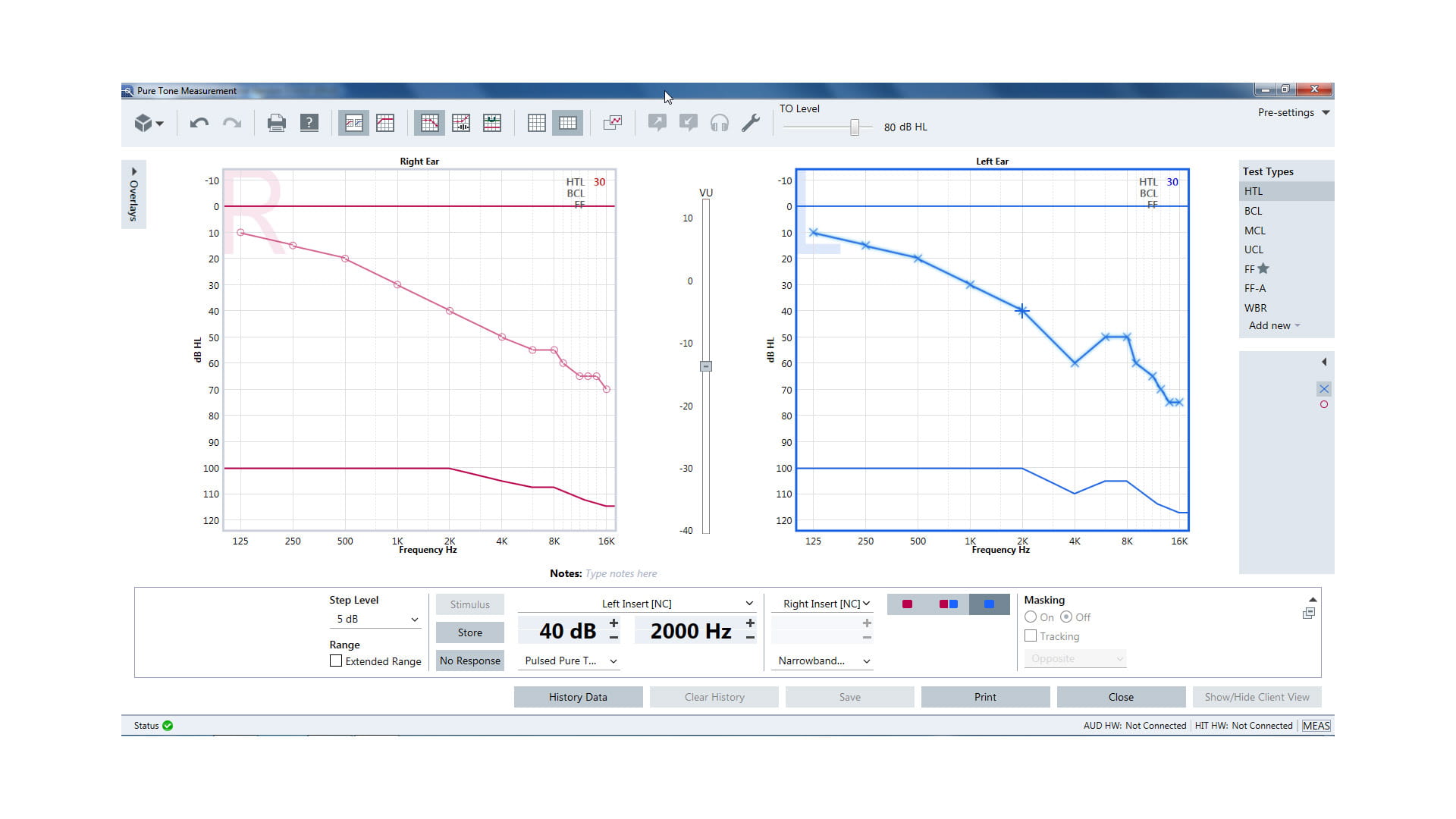 Unity 3 - for precise diagnostics and effortless fitting. | Signia Pro