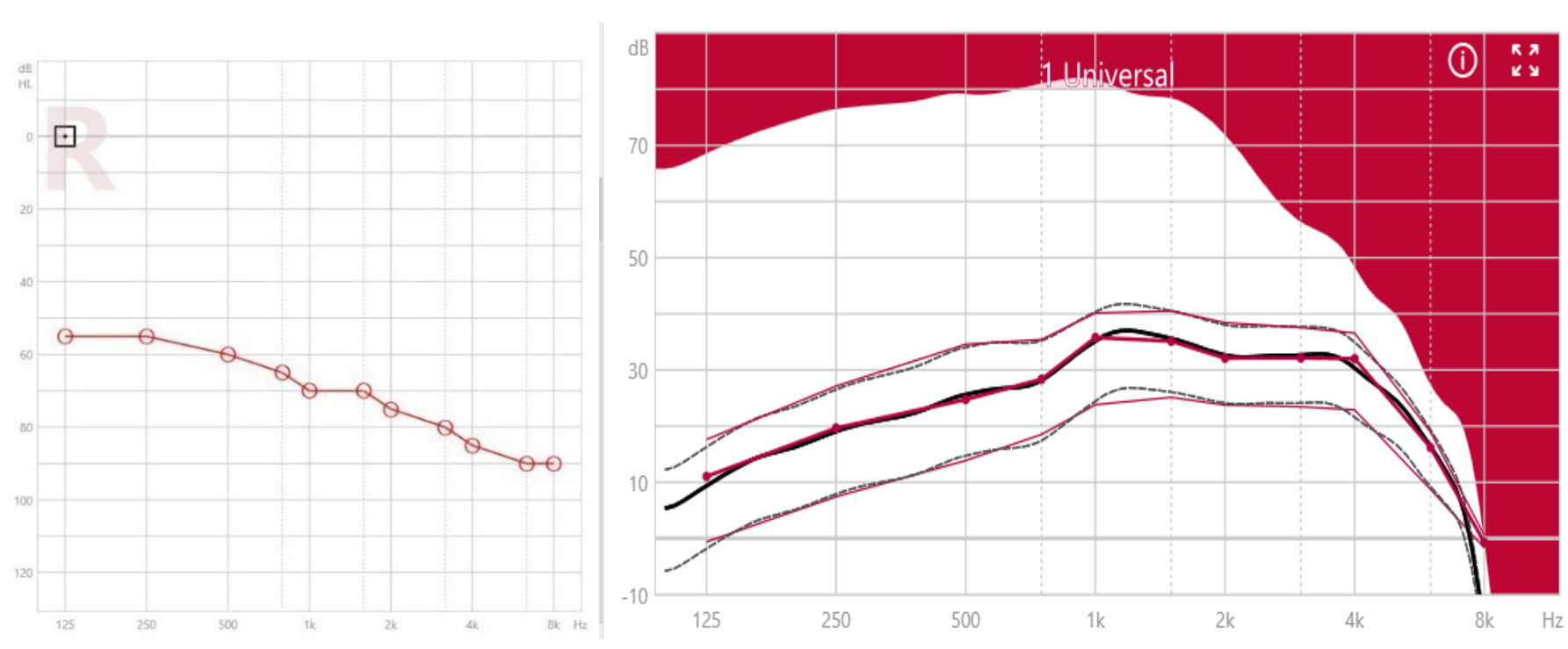Signia Xperience Super Power devices - the true heroes | Signia Pro