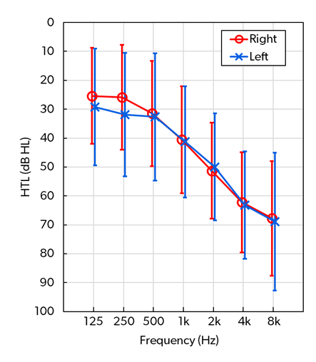 Speech understanding study, Nov 2024, picture 1