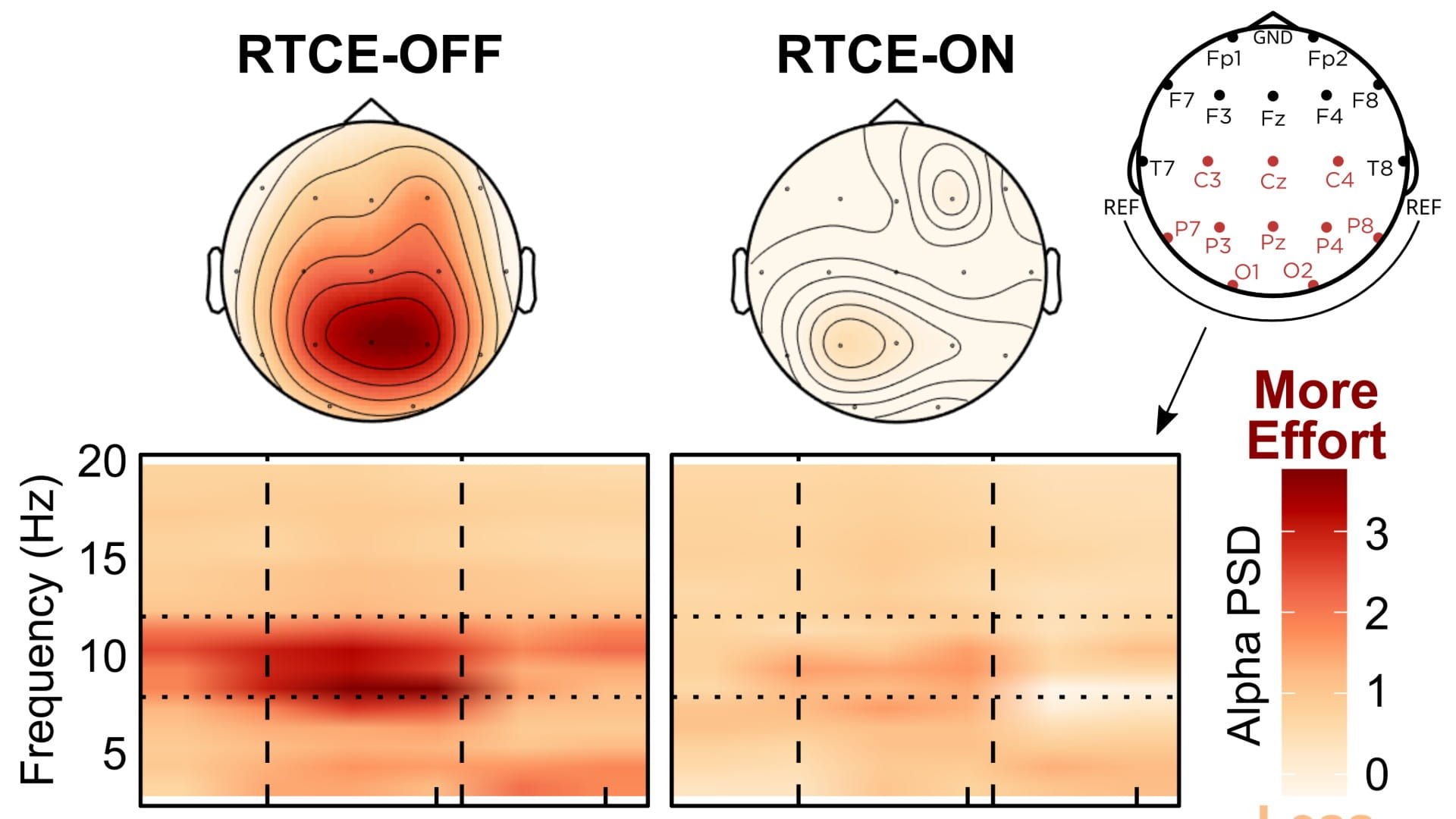Signia IX enhances the brain’s response to speech and reduces listening effort in noisy group conversations
